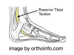 Barking Dog Shoes reviews and recommends the best footwear for people with various foot issues (as well as for women with average feet for whom comfort is a high priority).